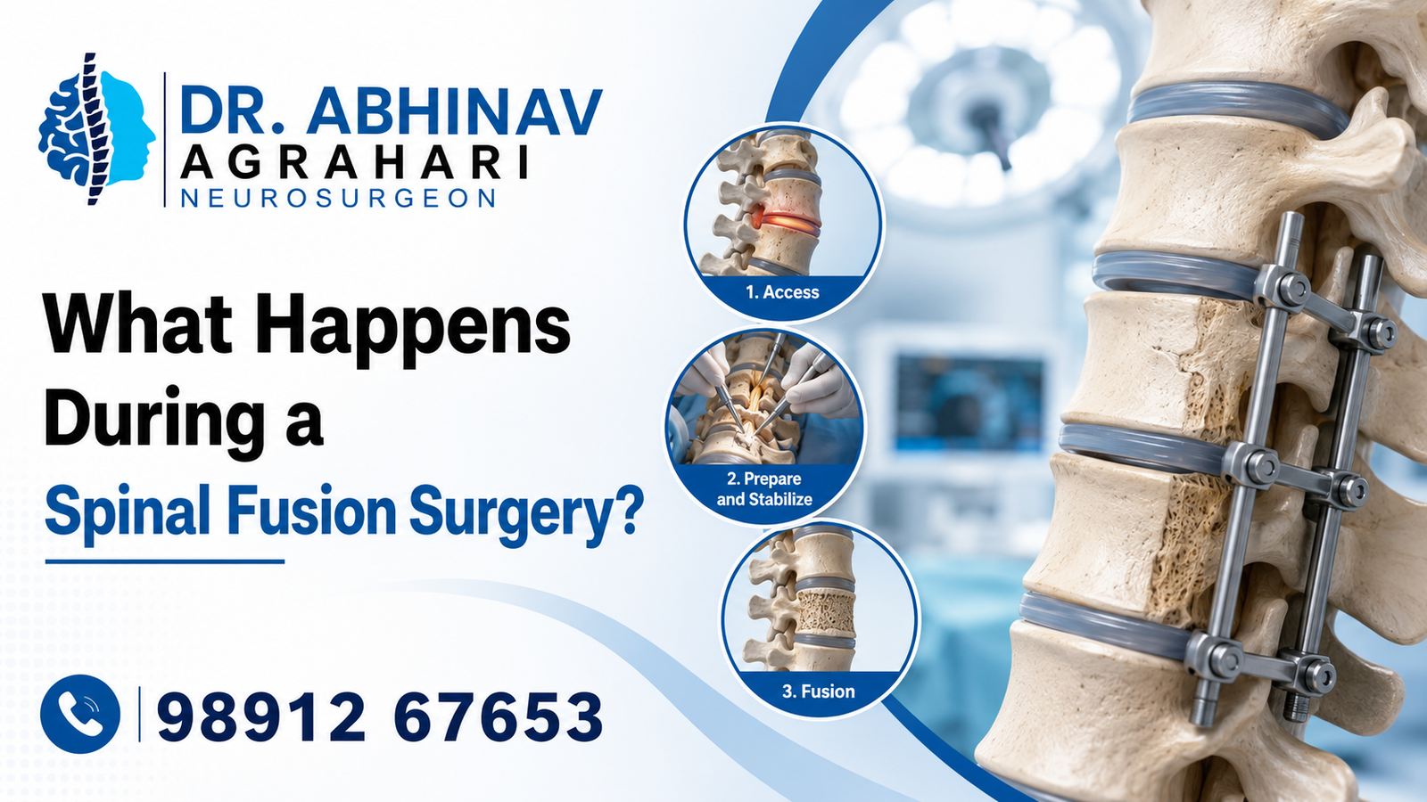 What Happens During a Spinal Fusion Surgery? | Best Spine Surgeon in Okhla